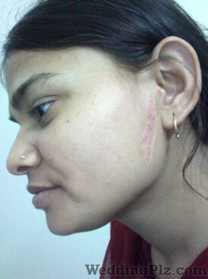 Skin Laser Centre Slimming Beauty and Cosmetology Clinic weddingplz