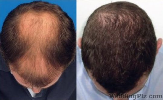 HairRX Slimming Beauty and Cosmetology Clinic weddingplz