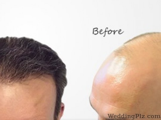 Dr Devesh Hair Transplant and Cosmetic Clinic Slimming Beauty and Cosmetology Clinic weddingplz