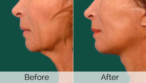 Dr. Batras Slimming Beauty and Cosmetology Clinic weddingplz