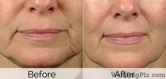 Dr Alkas Skin Institute Slimming Beauty and Cosmetology Clinic weddingplz