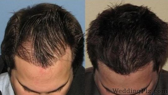 Asian Hair And Skin Center Slimming Beauty and Cosmetology Clinic weddingplz