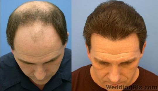 Dr HairCare And Slimming Clinic Slimming Beauty and Cosmetology Clinic weddingplz