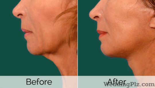 Akshatha Skin Care Clinic Slimming Beauty and Cosmetology Clinic weddingplz