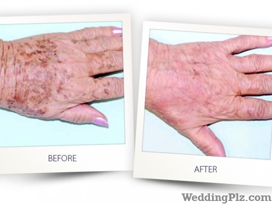 Sai Shree Facial Cosmetic Laser Center Slimming Beauty and Cosmetology Clinic weddingplz