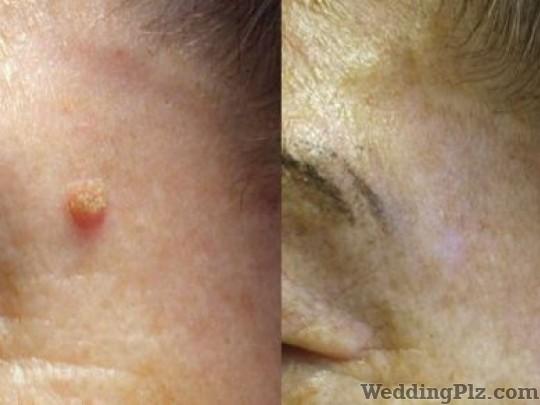 Sai Shree Facial Cosmetic Laser Center Slimming Beauty and Cosmetology Clinic weddingplz