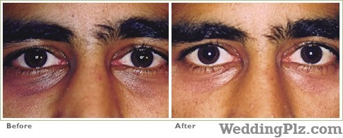 Sai Shree Facial Cosmetic Laser Center Slimming Beauty and Cosmetology Clinic weddingplz