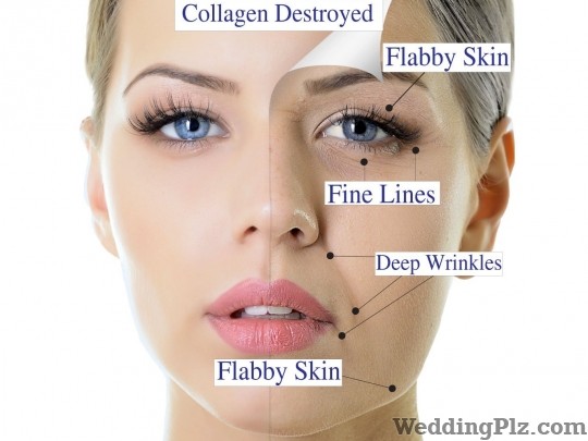 Sai Shree Facial Cosmetic Laser Center Slimming Beauty and Cosmetology Clinic weddingplz