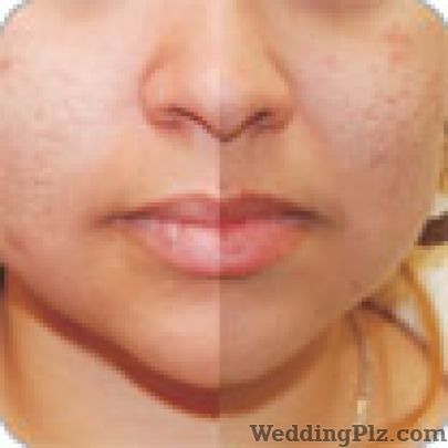 Alina Wellness Slimming Beauty and Cosmetology Clinic weddingplz