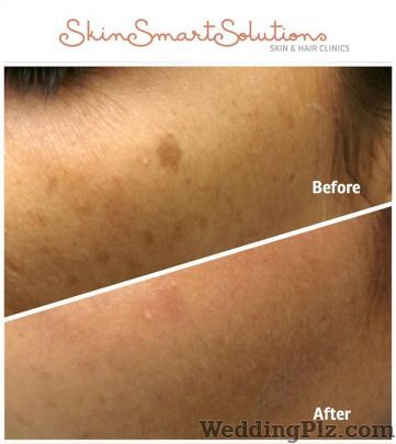 Skin Smart Solutions Slimming Beauty and Cosmetology Clinic weddingplz