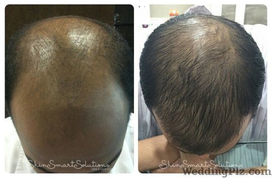 Skin Smart Solutions Slimming Beauty and Cosmetology Clinic weddingplz