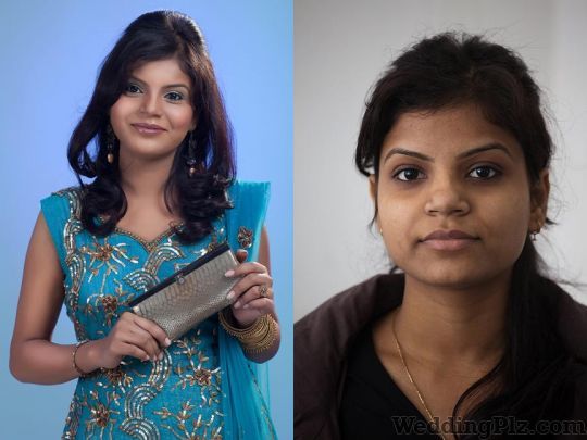 Alps Cosmetic Clinic And Beauty Academies Beauty Parlours weddingplz