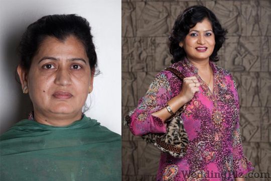 Alps Cosmetic Clinic And Beauty Academies Beauty Parlours weddingplz